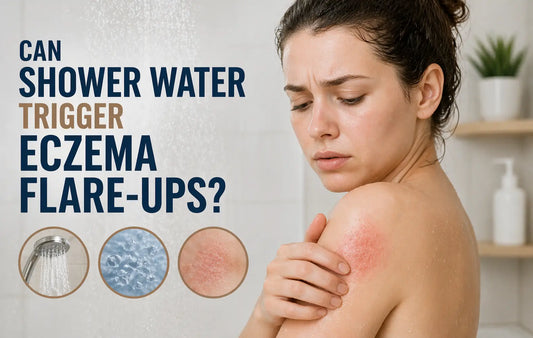 Can Shower Water Trigger Eczema Flare-Ups?