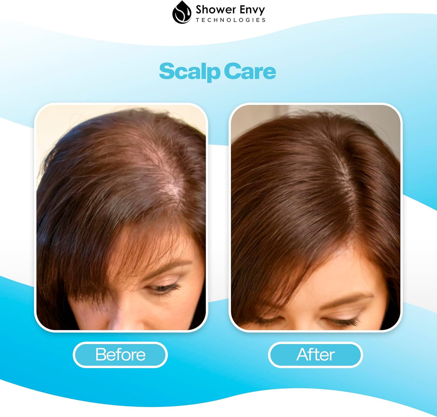 Filter Replacement for Showerevy 5.0