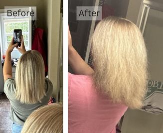 Hair Loss & Thinning