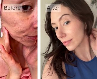 Sensitive Skin