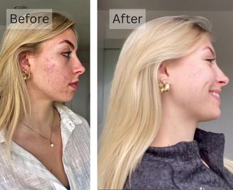 Sensitive Skin