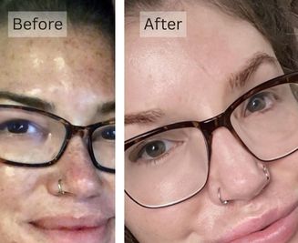 Sensitive Skin